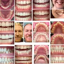Agave Dental